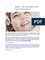 Dental Implants - The Best Way To Get Teeth Replacement
