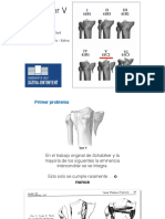 Fracturas de Mesetas Tibiales Tipo V de Schatzker 1