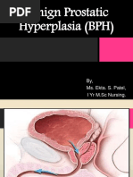 Benign Prostatic Hyperplasia (BPH) : By, Ms. Ekta. S. Patel, I Yr M.SC Nursing