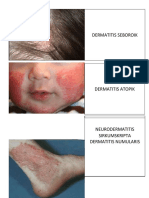 DERMATITIS GAMBAR