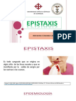 EPISTAXIS IRM MARIA FERNANDA SILVA.pptx