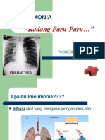 Pneumonia (20-01-2018)