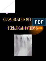 174837760-Classification-of-Pulpal-Periapical-Pathosis.pdf
