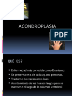 Acondroplasia