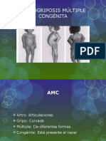 Artrogriposis Múltiple Congénita