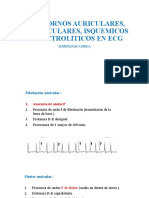 Trastornos Ventriculares en Ecg para Aula Virtual