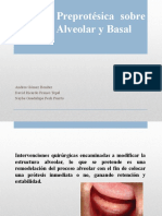 Cirugía Preprotésica Sobre El Hueso Alveolar y Basal
