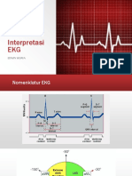 Interpretasi EKG secara sistematis dan akurat