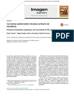 Imagen: Carcinoma Epidermoide Intraóseo Primario de Mandíbula