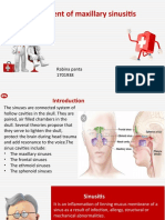 Treatment of Maxillary Sinusitis