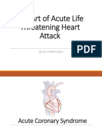The Art of Acute Life Threateening Heart Attack NUR HARYONO