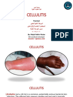 Cellulitis Infection Causes, Symptoms and Treatment
