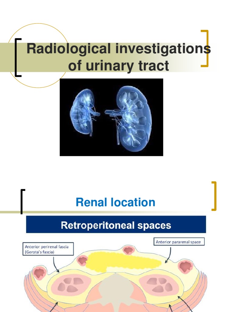 Radiological Investigations of Urinary Tract | PDF | Ct Scan | Kidney