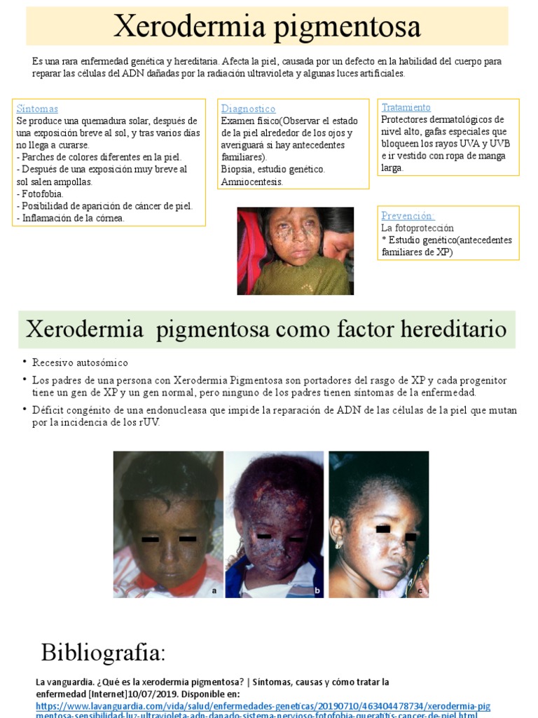 Xerodermia Pigmentosa: Síntomas y Tratamiento | PDF | Cáncer | Piel