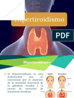 hipertiroidismo