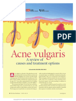 Acne Vulgaris A Review of Causes and Treatment.6