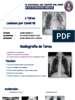 Radiografía pulmonar Covid-19