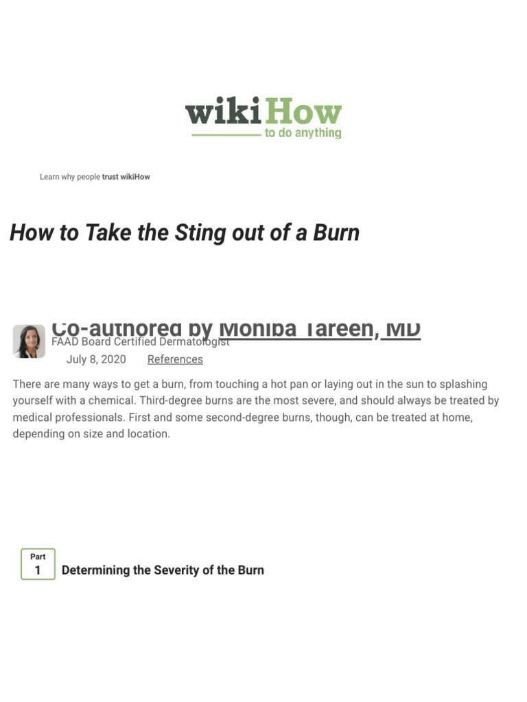 How To Take The Sting Out of A Burn (With Pictures) PDF Burn