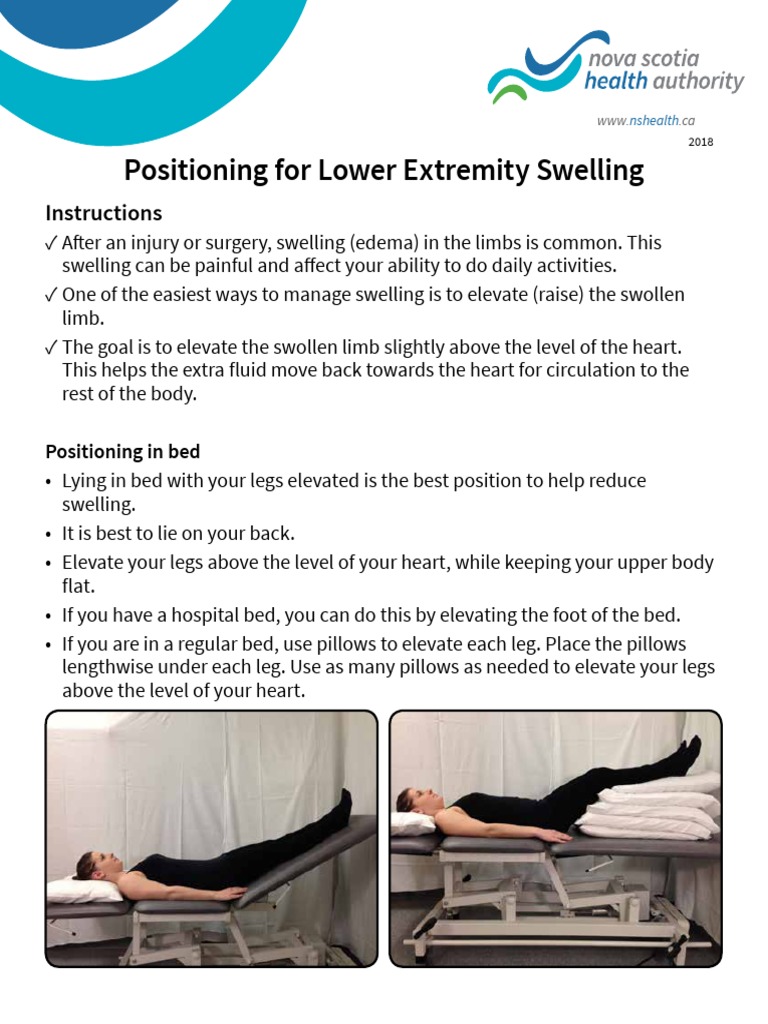 Positioning For Lower Extremity Swelling Instructions PDF Edema