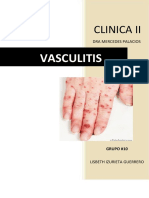 VASCULITIS.docx