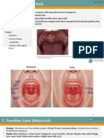 Macam Tonsil