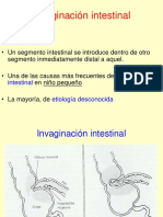 Invaginacion Intestinal PDF