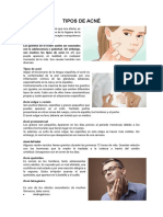 TIPOS DE ACNÉ.docx