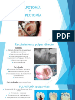 Pulpotomía y Pulpectomía PDF