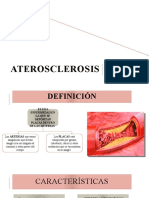 Aterosclerosis: Enfermedad de las arterias