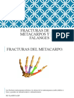 Fracturas de Metacarpos y Falanges