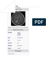 Investigacion de Tumor Cerebral