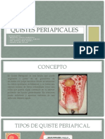 Quistes Periapicales