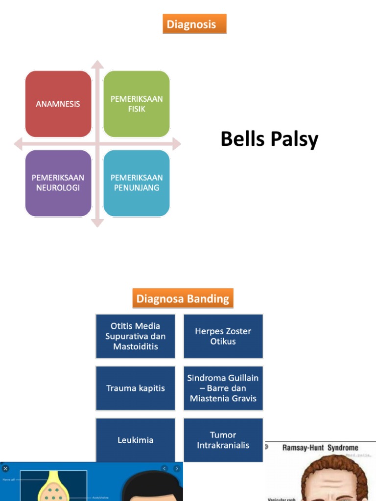 Bell's Palsy Diagnosis Guide | PDF