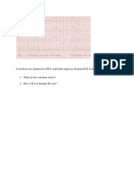 Newborn with Birth Asphyxia - ECG Findings and Management