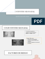 Conjuntivitis Neonatal 1