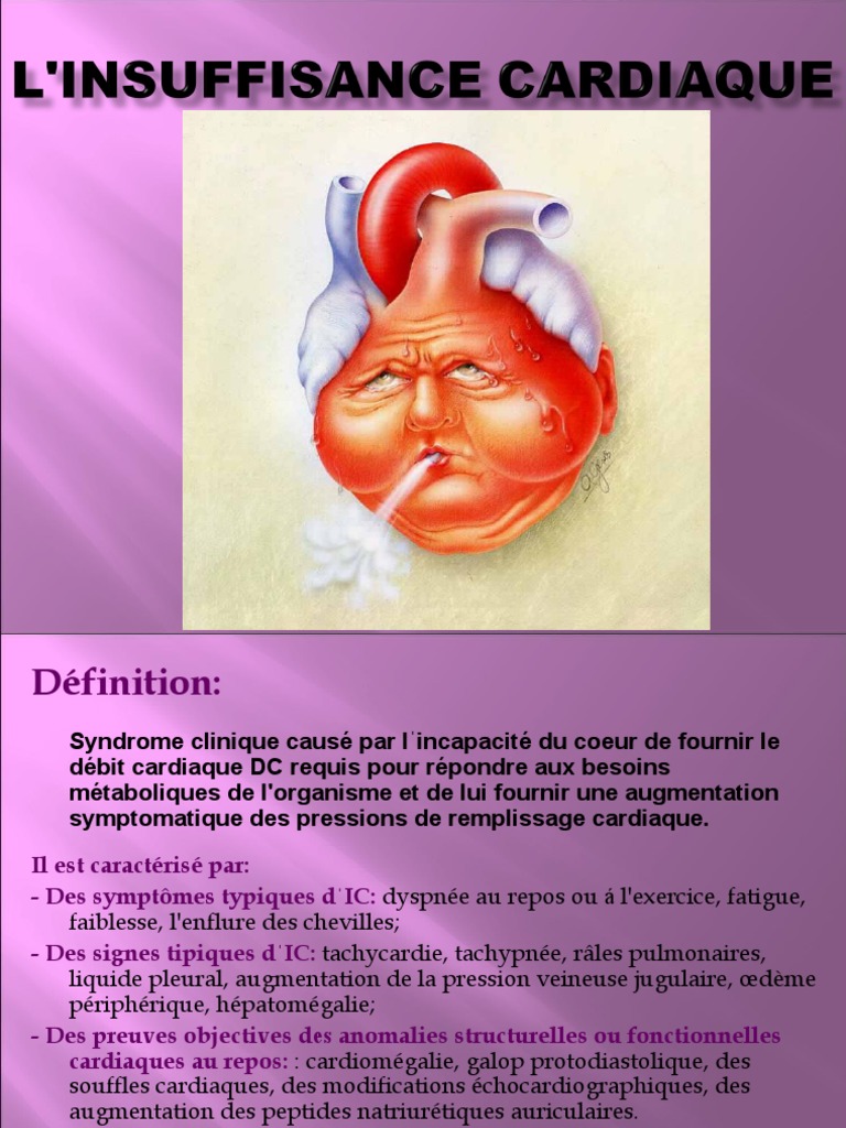 Insuffisance Cardiaque : Définition et Symptômes | PDF | Insuffisance ...