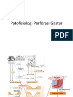 Patofisiologi Perforasi Gaster