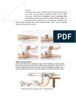 Reposisi diskolasi Hip Joint.docx