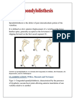 Varieties of Spondylolisthesis: (A) Normal, (B) Congenital, (C) Isthmic, (D) Traumatic, (E) Degenerative, and (F) Pathological