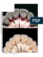 Clinical Considerations and Rationale For The Use of Simplified Instrumentation in Occlusal Rehabilitation Part 2, Stefano Gracis