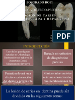 Rde Caries