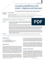 juvenile nasopharyngeal angiofibroma with intracranial extension- diagnosis and treatment