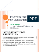 Protein Energy Under Nutrition: Getnet Aschale