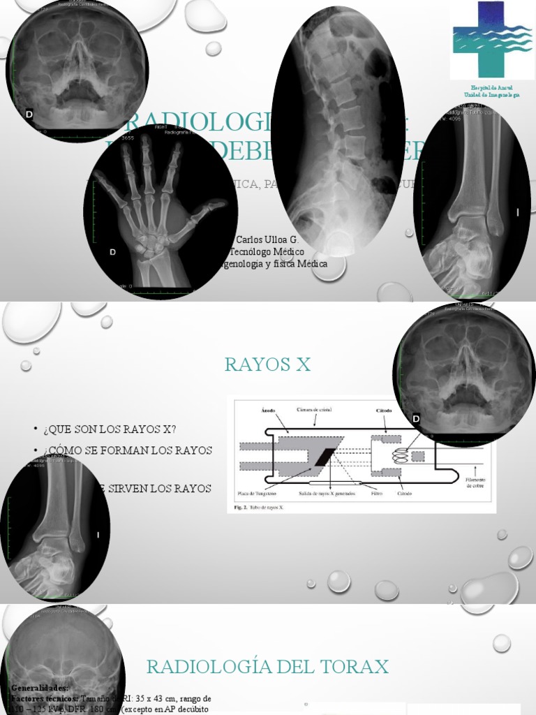 Radiologia Digital: Lo Que Debemos Saber: Posicionamiento, Técnica ...