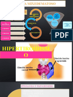 Coma Mixedematoso