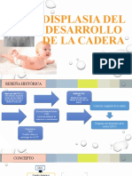 Displasia Del Desarrollo de La Cadera (DDC)