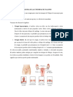 Ligadura Trompas de Falopio