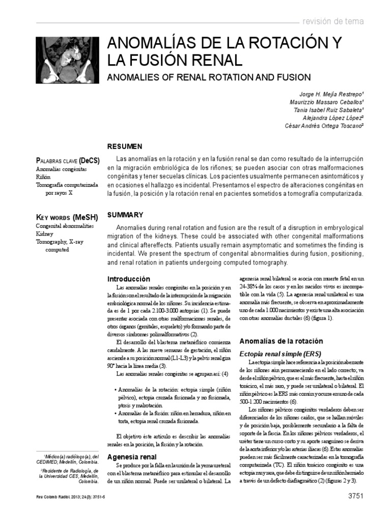 Ectopia y Malrotación Renal Congénita | PDF | Riñón | Pelvis