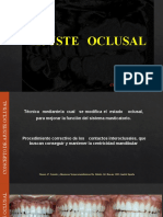 291943046-AJUSTE-oclusal-20013-pptx.pptx