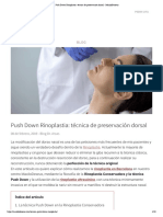 Push Down Rinoplastia - Técnica de Preservación Dorsal - MaxiloDexeus